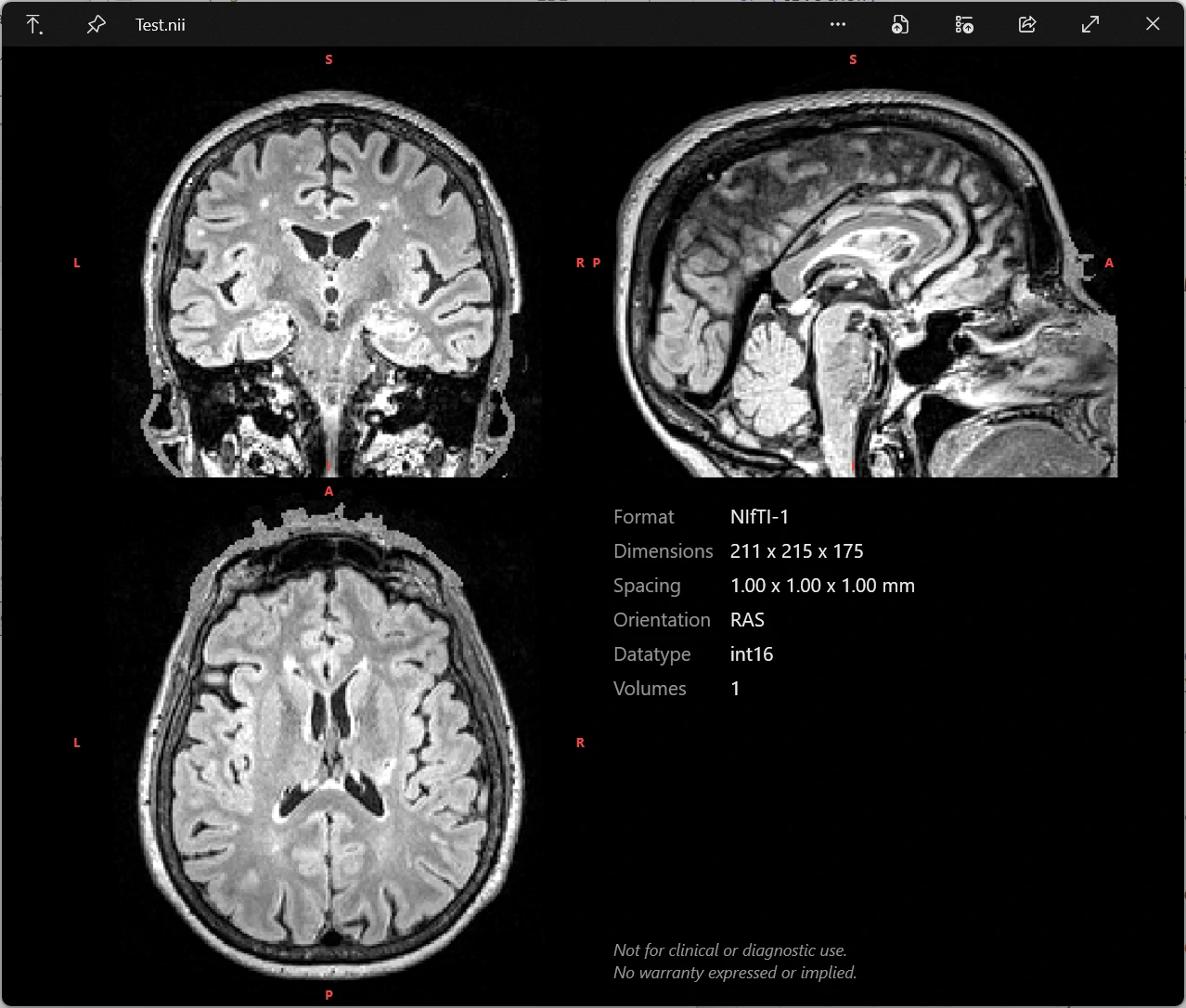 MIQ-Win QuickLook preview showing a orthogonal slice grid and metadata panel
